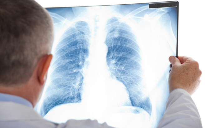 Trách nhiệm của nhân viên vận hành thiết bị X - quang chẩn đoán y tế về việc bảo đảm an toàn bức xạ cho người bệnh