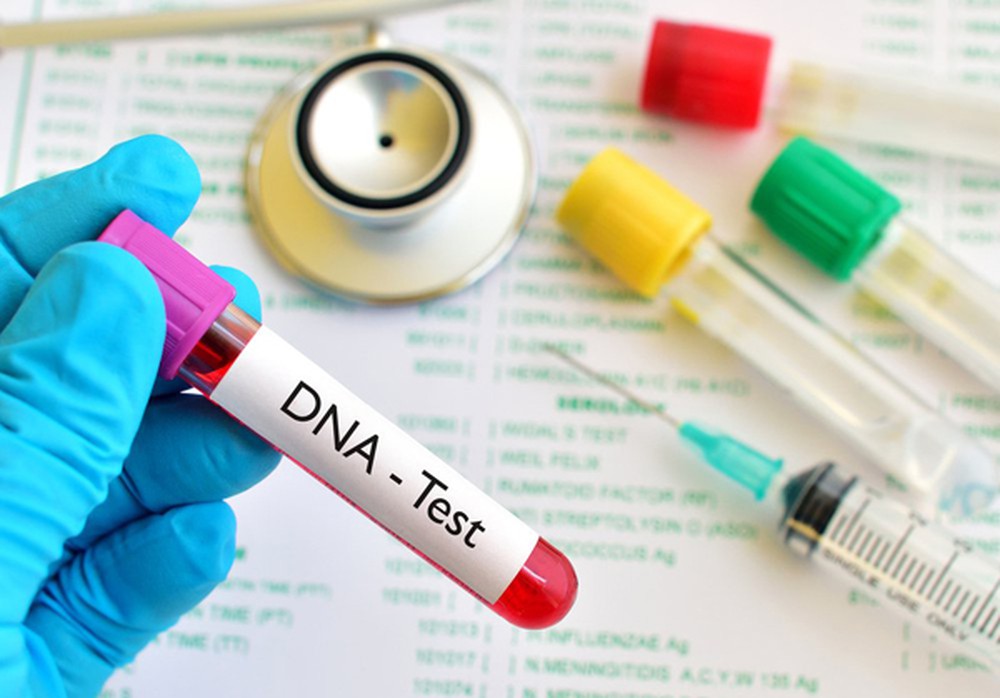 Ai có trách nhiệm làm xét nghiệm ADN khi đòi cấp dưỡng cho con?