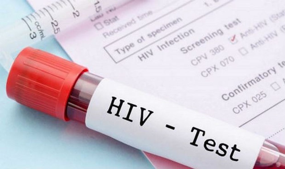 Chi phí xét nghiệm HIV đối với người nhận mô, bộ phận cơ thể người và người nhận tinh trùng, noãn, phôi