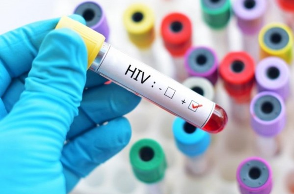 Trình tự thông báo kết quả xét nghiệm HIV dương tính cho vợ, chồng hoặc người chuẩn bị kết hôn với người nhiễm HIV